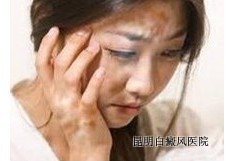 女孩白癜风使用化妆品注意事项